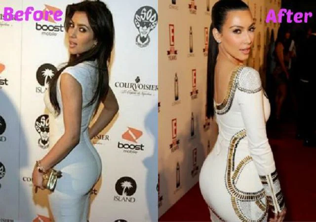 77-Plastic-Surgery_celebrities-with-butt-implants.jpg