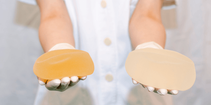how-long-do-breast-implants-last-in-2019